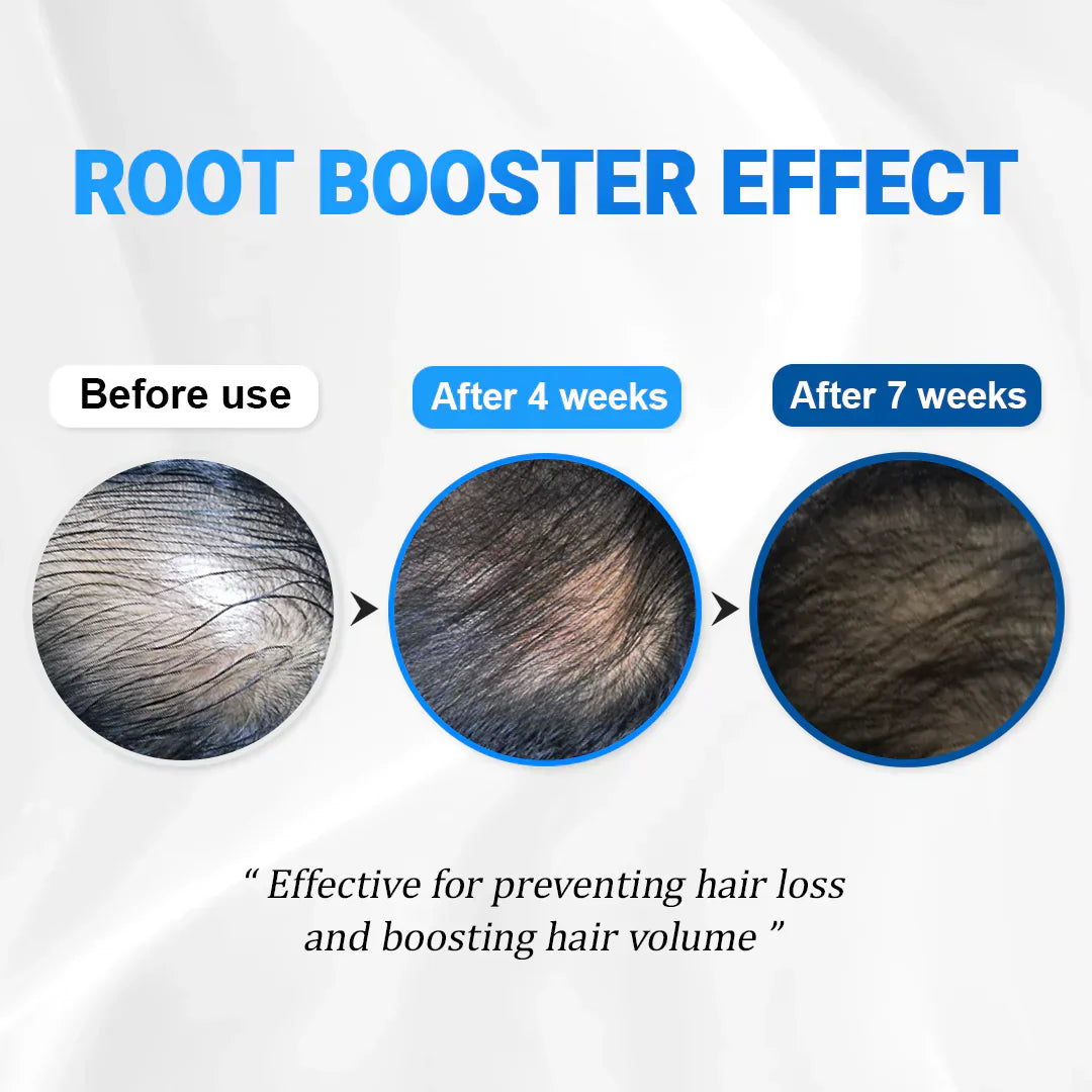 RootBloom™ Hair Growth Elixir