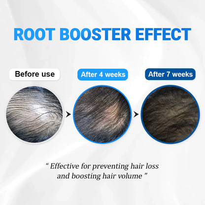 RootBloom™ Hair Growth Elixir