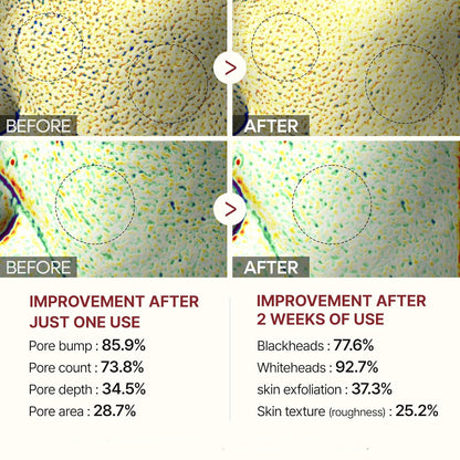 AuroraRice™ Dual Radiance Peel